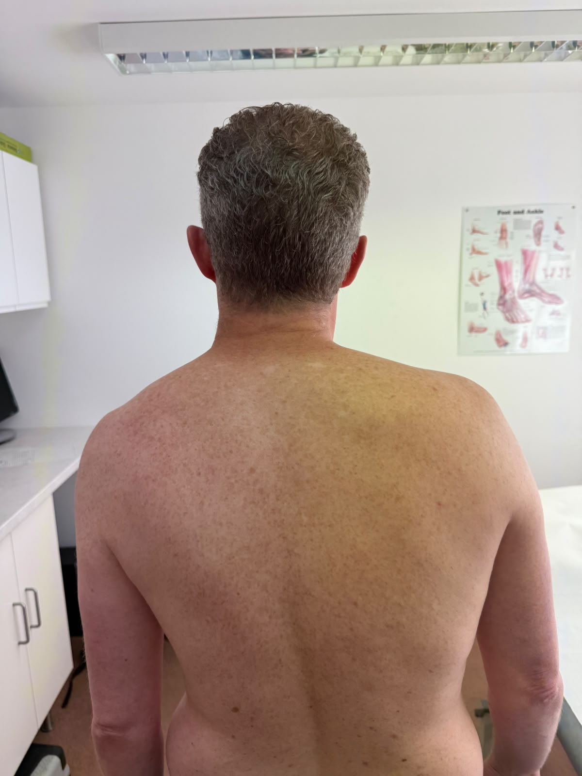 Patient progress after physiotherapy treatment - Case 1