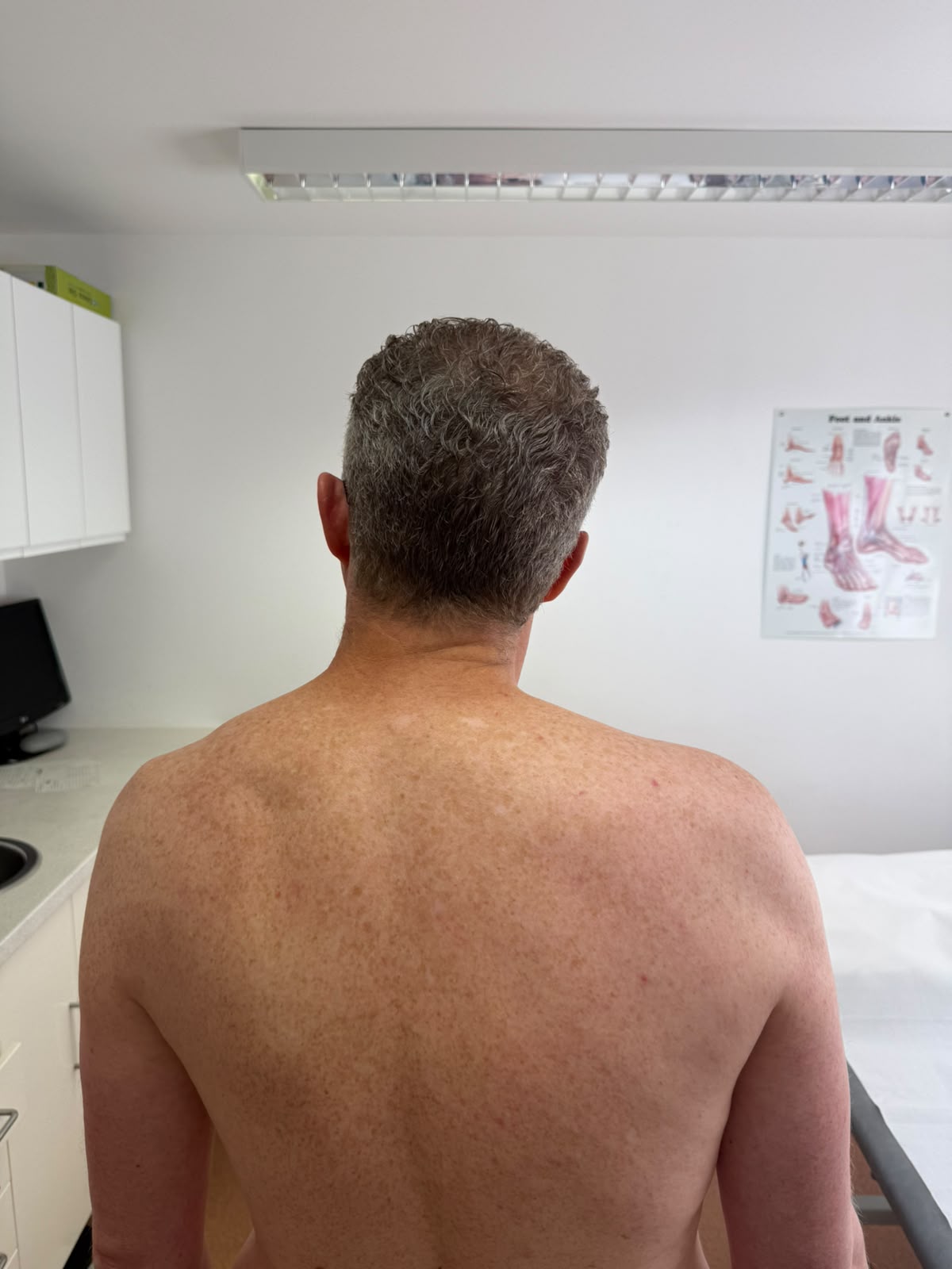 Patient condition before physiotherapy treatment - Case 1