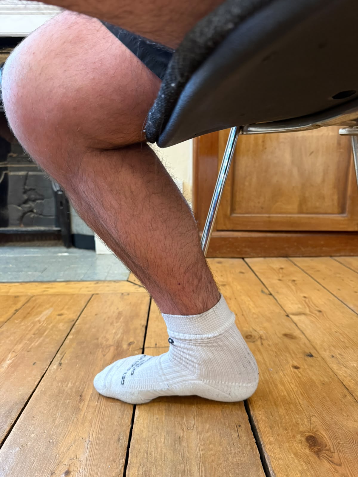 Patient condition before physiotherapy treatment - Case 2